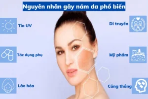 Nguyên nhân hình thành nám da