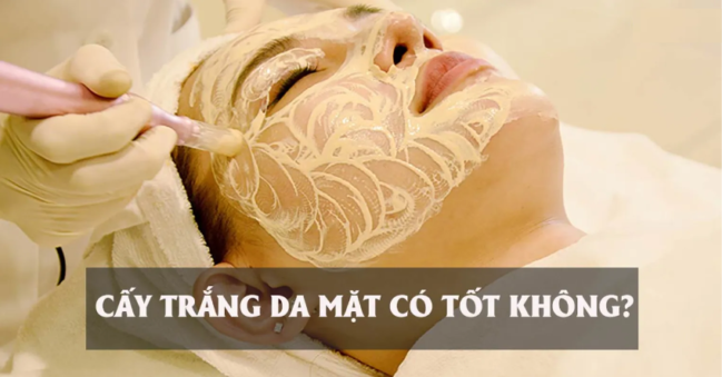 Cấy trắng da mặt có tốt ko