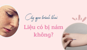 Cấy que tránh thai dễ khiến da bị nám